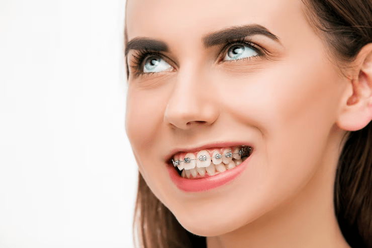 An Orthodontists Care Will Give You a Beautiful Smile