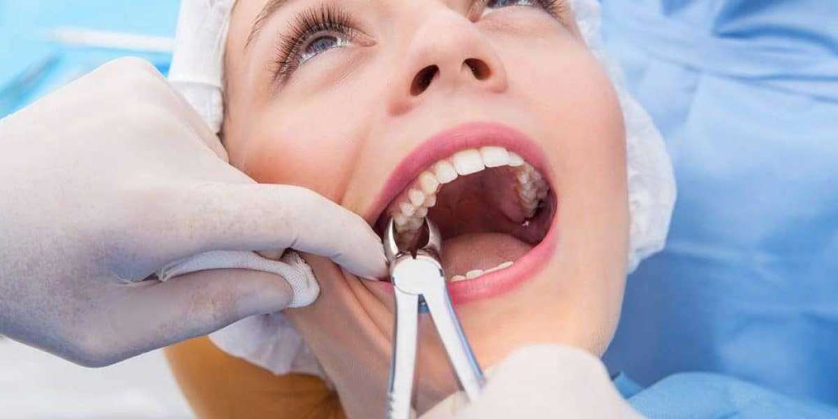 Comprehensive Guide to Expert Tooth Extractions in Tallahassee, FL