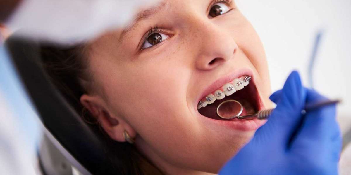 Tooth Coloured Braces VS Transparent Braces. Find Out What Works for You!