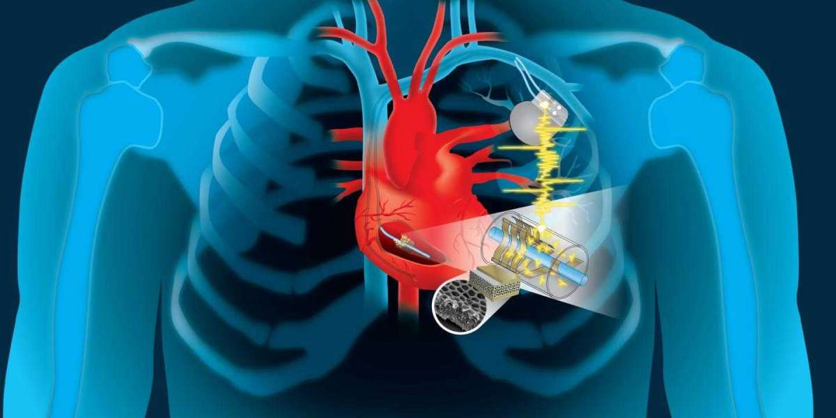 Cardiac Implants Market Insights & Forecast Covering Growth Inclinations & Development Strategies