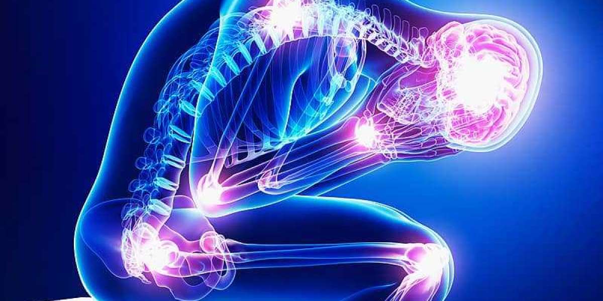 Understanding the Origins of Nerve Pain