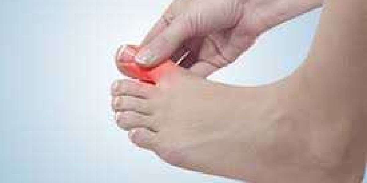 Understanding Toe Pain: Causes and Solutions