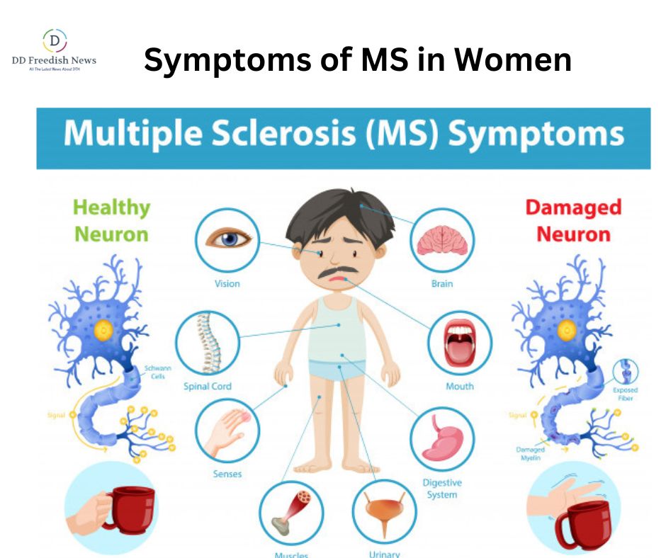Unveiling the Signs: Symptoms of MS in Women